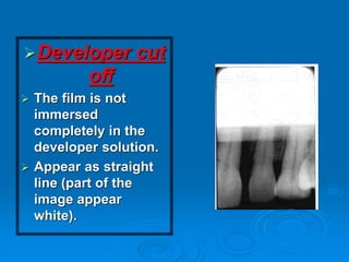 Developer Cut Off 7. ERRORS of dental x ray might happen.ppt