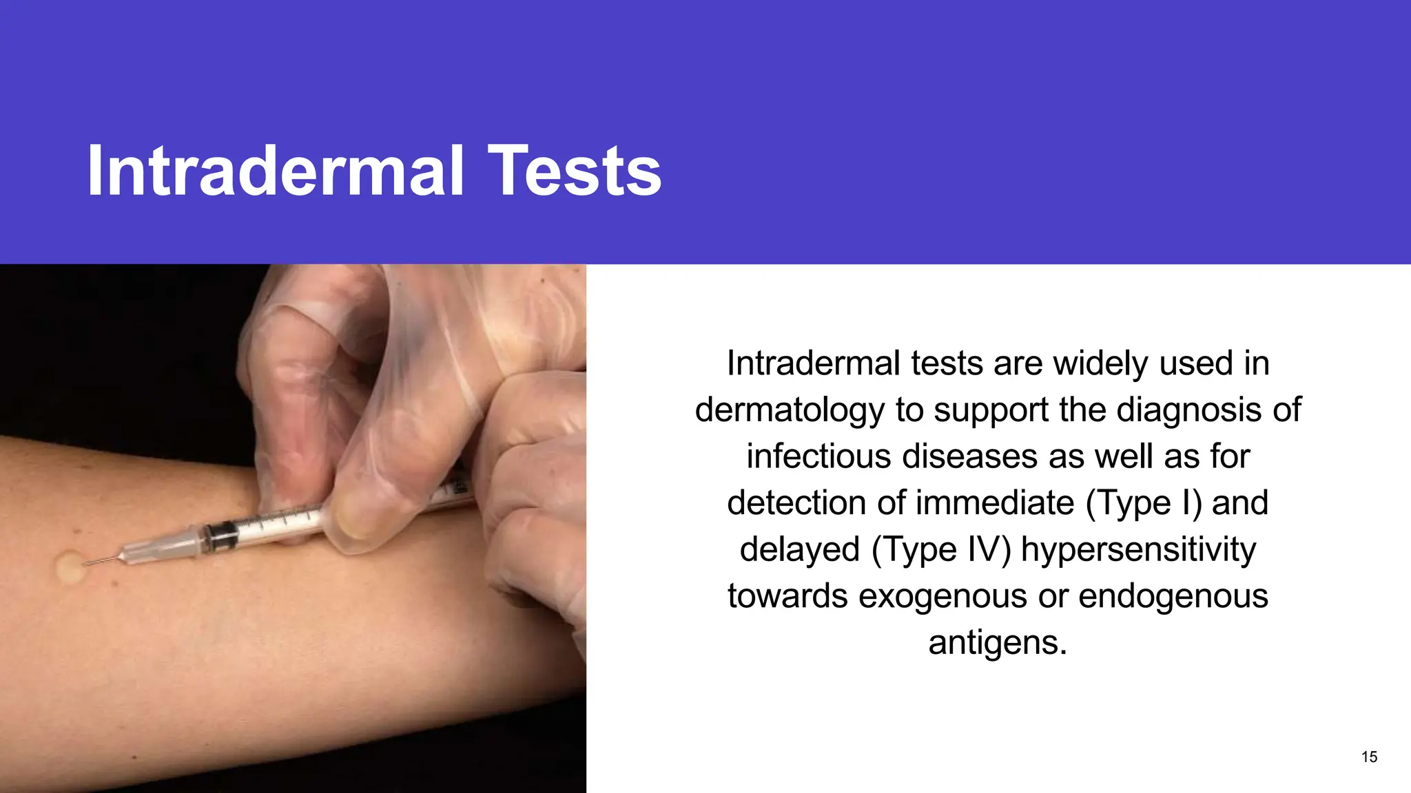 Intradermal Tests
Presentation title
Intradermal tests are widely used in
dermatology to support the diagnosis of
infectious diseases as well as for
detection of immediate (Type I) and
delayed (Type IV) hypersensitivity
towards exogenous or endogenous
antigens.
15
 