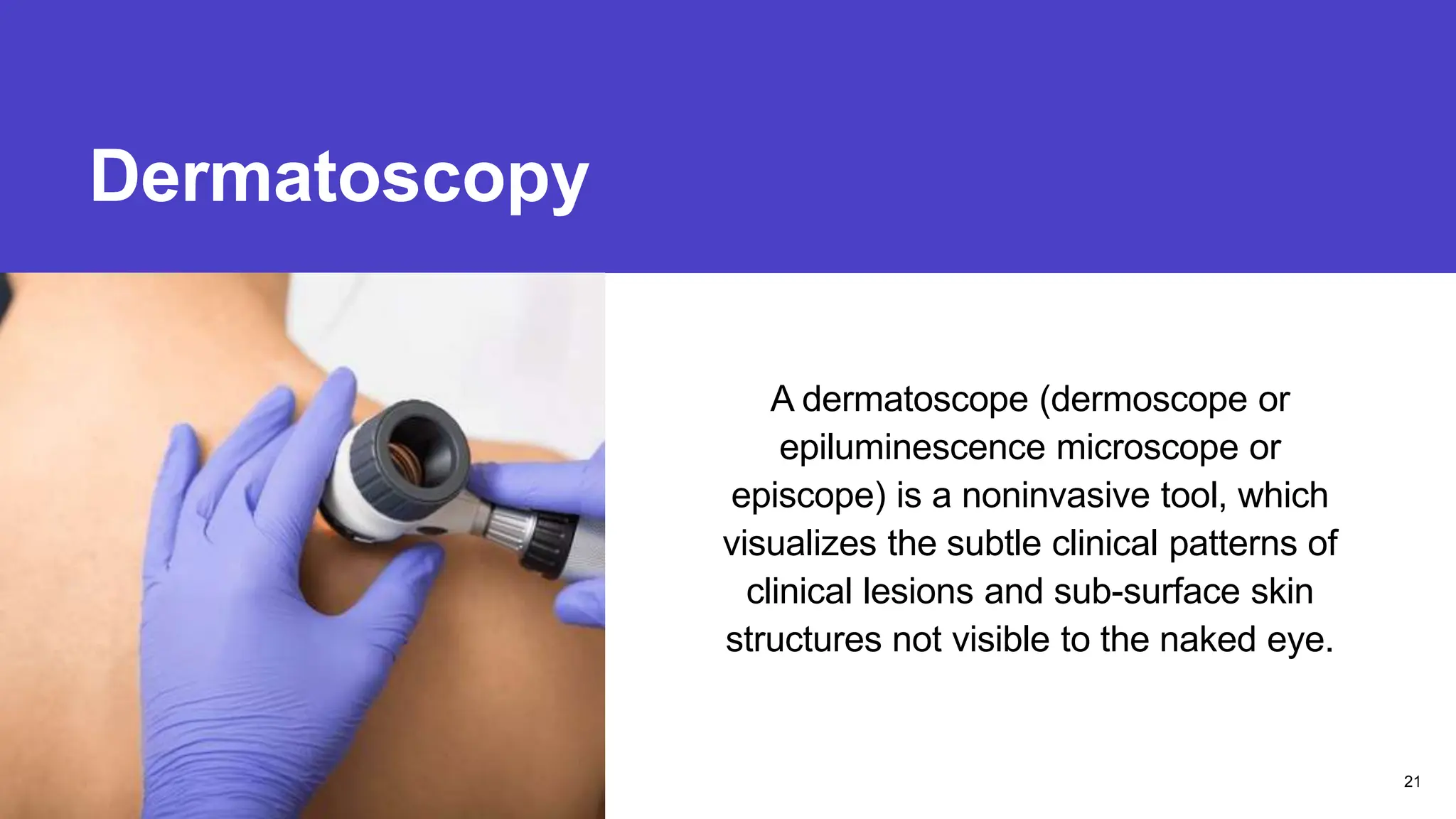 Dermatoscopy
Presentation title
A dermatoscope (dermoscope or
epiluminescence microscope or
episcope) is a noninvasive tool, which
visualizes the subtle clinical patterns of
clinical lesions and sub-surface skin
structures not visible to the naked eye.
21
 