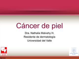 Cáncer de piel
Dra. Nathalia Malvehy H.
Residente de dermatología
Universidad del Valle
 