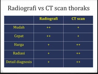 Radiografi vs CT scan thoraks
Radiografi CT scan
Mudah ++ +
Cepat ++ +
Harga + ++
Radiasi + ++
Detail diagnosis + ++
 