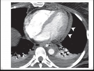 7.-diagnostik-trauma-tttthoraks-dada.pdf