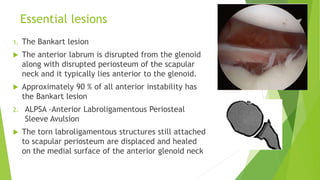 7. Approach to shoulder instability.pptx