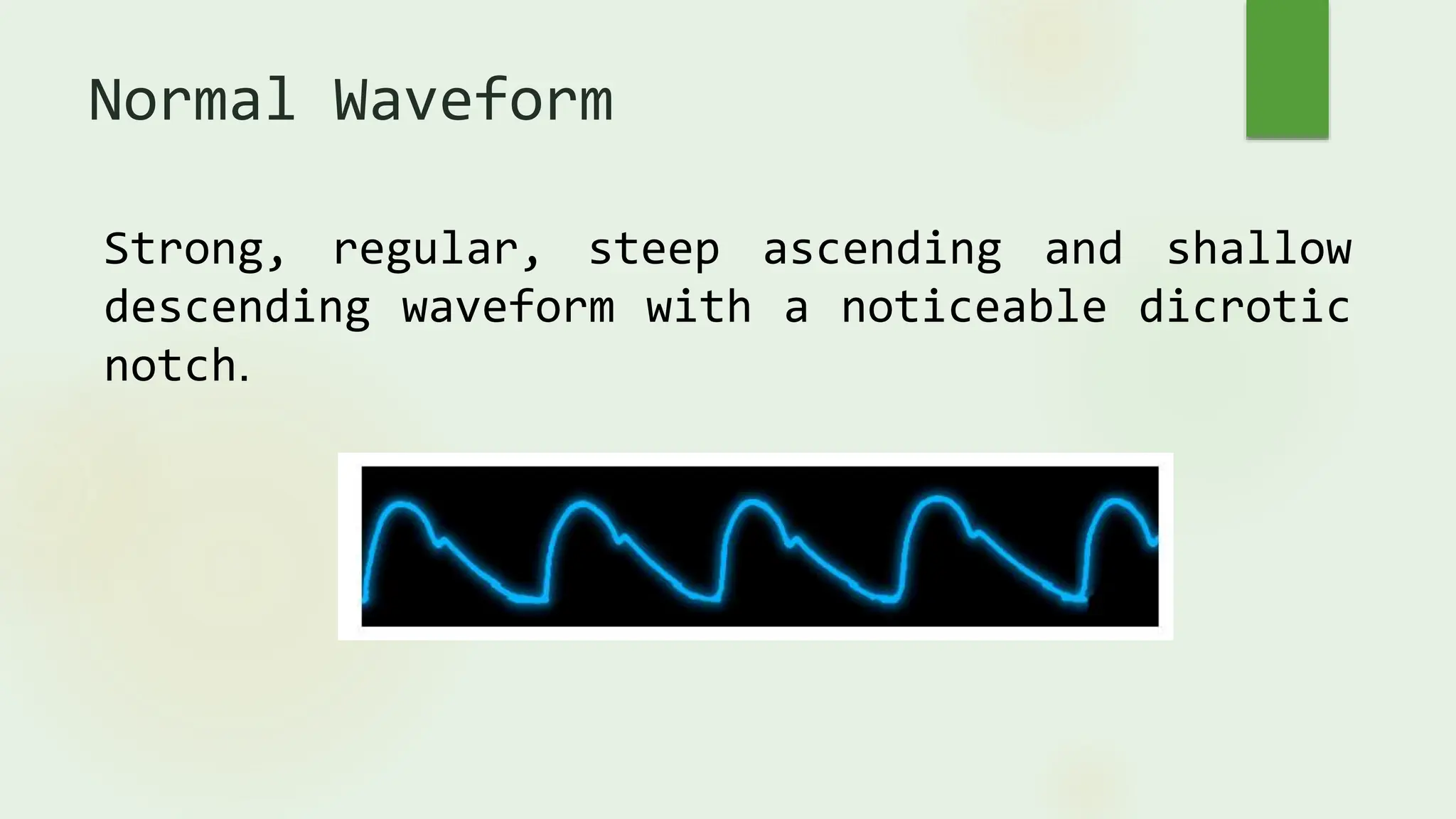 Normal O2 Waveform 7.pulse oximetry. pptx | PPTX