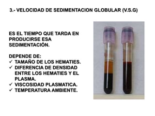 Vsg Lab 7.- FISIOLOGIA DE LA SANGRE.ppt,,,,,,,,,,,,,,,,,,,,,,,,,,,,,,,,, | PPT