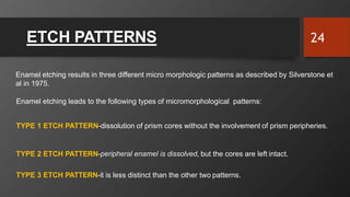 ETCH PATTERNS
Enamel etching results in three different micro morphologic patterns as described by Silverstone et
al in 1975.
Enamel etching leads to the following types of micromorphological patterns:
TYPE 1 ETCH PATTERN-dissolution of prism cores without the involvement of prism peripheries.
TYPE 2 ETCH PATTERN-peripheral enamel is dissolved, but the cores are left intact.
TYPE 3 ETCH PATTERN-it is less distinct than the other two patterns.
24
 