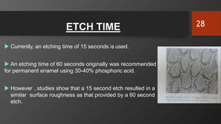 ETCH TIME
 Currently, an etching time of 15 seconds is used.
 An etching time of 60 seconds originally was recommended
for permanent enamel using 30-40% phosphoric acid.
 However , studies show that a 15 second etch resulted in a
similar surface roughness as that provided by a 60 second
etch.
28
 