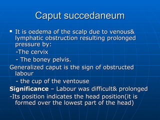 7. Theories of onset of labour and normal labour.ppt