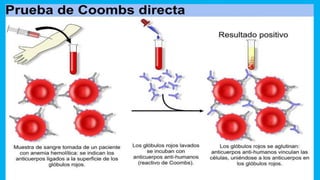 Rex Coombs 7._PRUEBA_DE_COOMBS_DIRECTO_E_INDIRECTO.pdf