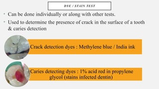 DYE / STAIN TEST
• Can be done individually or along with other tests.
• Used to determine the presence of crack in the surface of a tooth
& caries detection
Crack detection dyes : Methylene blue / India ink
Caries detecting dyes : 1% acid red in propylene
glycol (stains infected dentin)
 
