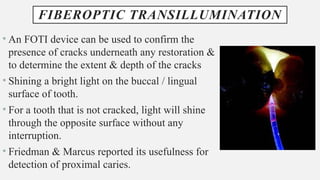 FIBEROPTIC TRANSILLUMINATION
• An FOTI device can be used to confirm the
presence of cracks underneath any restoration &
to determine the extent & depth of the cracks
• Shining a bright light on the buccal / lingual
surface of tooth.
• For a tooth that is not cracked, light will shine
through the opposite surface without any
interruption.
• Friedman & Marcus reported its usefulness for
detection of proximal caries.
 