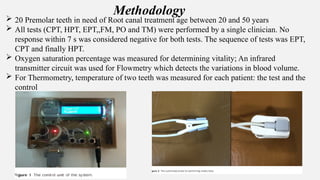 Methodology
 20 Premolar teeth in need of Root canal treatment age between 20 and 50 years
 All tests (CPT, HPT, EPT,,FM, PO and TM) were performed by a single clinician. No
response within 7 s was considered negative for both tests. The sequence of tests was EPT,
CPT and finally HPT.
 Oxygen saturation percentage was measured for determining vitality; An infrared
transmitter circuit was used for Flowmetry which detects the variations in blood volume.
 For Thermometry, temperature of two teeth was measured for each patient: the test and the
control
 
