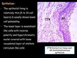 7. ameloblastoma - Copy.ppt ameloblastoma | PPT
