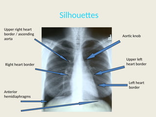 7. Heart anatomy cardiovascular system I.pptx
