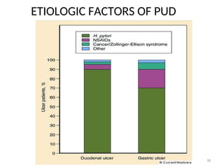ETIOLOGIC FACTORS OF PUD
18
 