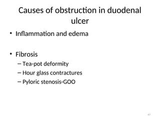 Causes of obstruction in duodenal
ulcer
• Inflammation and edema
• Fibrosis
– Tea-pot deformity
– Hour glass contractures
– Pyloric stenosis-GOO
47
 