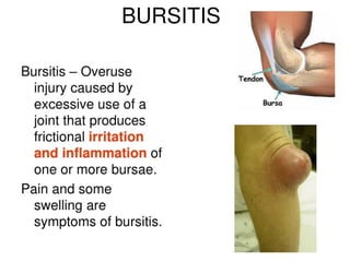 Human Particulation Biomechanics of Human Articulation 2.docx