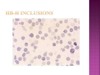 HB-H INCLUSIONS
 