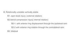 B. Rotationally unstable vertically stable
B1. open book injury ( external rotation)
B2.lateral compression injury( internal rotation)
B2-1. with anterior ring displacement through the ipsilateral rami
B2-2 with anterior ring rotation through the contralateral rami
B3. bilateral
 