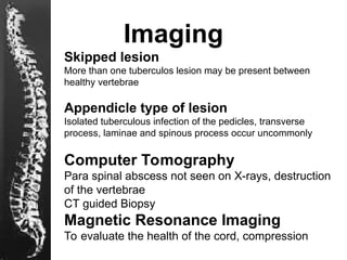 7. Presentation Spinal Tuberculosis-modified.ppt