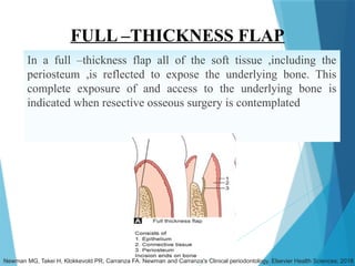 FULL –THICKNESS FLAP
In a full –thickness flap all of the soft tissue ,including the
periosteum ,is reflected to expose the underlying bone. This
complete exposure of and access to the underlying bone is
indicated when resective osseous surgery is contemplated
Newman MG, Takei H, Klokkevold PR, Carranza FA. Newman and Carranza's Clinical periodontology. Elsevier Health Sciences; 2018
 
