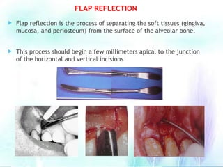 FLAP REFLECTION
 Flap reflection is the process of separating the soft tissues (gingiva,
mucosa, and periosteum) from the surface of the alveolar bone.
 This process should begin a few millimeters apical to the junction
of the horizontal and vertical incisions
 