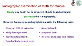 exodontia dental surgery for dental students | PDF