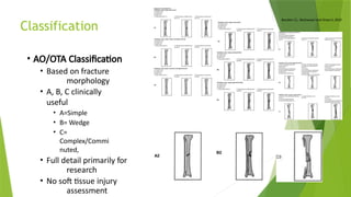 Tibial shaft fractures Managing soft tissues and infection | PPTX