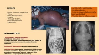 CLÍNICA
• Signos sistémicos inespecíficos
• Apnea
• Dificultad respiratoria
• Letargia
• RECHAZO VÍA ORAL
• Inestabilidad térmica
• Hipotensión.
• DISTENSIÓN ABDOMINAL
• Residuo gástrico
• Eritema de pared abdominal e
hipersensibilidad
• Vómito, diarrea y Rectorragia
DIAGNÓSTICO
RADIOGRAFÍA SIMPLE ABDOMEN:
PATRÓN DE MIGAJA DE PAN
• Asa fija intestinal (motivo de consulta Qx), edema de
asas, neumatosis, neumoperitoneo (perforación
intestinal)
ECOGRAFÍA ABDOMINAL: presencia de aire portal
LABORATORIO: Leucopenia, trombopenia, PCR elevado,
Acidosis metabólica. Hiponatremia es hallazgo de mal
pronóstico (relacionada a tercer espacio a nivel
abdominal – coagulopatía de consumo)
 