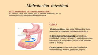 Malrotación intestinal
ROTACIÓN ANORMAL DE ASA DUODENO-YEYUNAL
El intestino crece mas rápido que la cavidad abdominal, en un
momento dado está fuera de la cavidad abdominal.
CLÍNICA
A) Asintomático: 1 de cada 200 nacidos vivos
tienen una anomalía de rotación asintomática
B) Sintomático Curso agudo: vomito biliar,
irritabilidad, colapso circulatorio súbito Obstrucción
intestinal (con o sin vólvulo – torsión del intestino
sobre sí mismo)
Curso crónico: eritema de pared abdominal,
hematemesis y melena, peritonitis, sepsis.
 