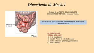 Divertículo de Meckel
Se trata de un RESTO DEL CONDUCTO
ONFALOMESENTÉRICO o conducto vitelino.
Localización: 50 – 75 cm de la válvula ileocecal, en el borde
antimesentérico
EPIDEMIOLOGÍA
REGLA DE DOS (2)
• 2 % de la población
• 2 pies (50-75cm) de válvula ileocecal
• 2 tejidos ectópicos (gástrico y pancreático)
• 2 años o menos.
 