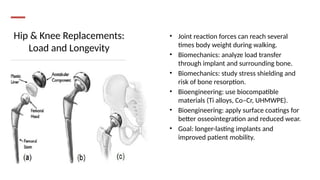 Hip & Knee Replacements:
Load and Longevity
• Joint reaction forces can reach several
times body weight during walking.
• Biomechanics: analyze load transfer
through implant and surrounding bone.
• Biomechanics: study stress shielding and
risk of bone resorption.
• Bioengineering: use biocompatible
materials (Ti alloys, Co–Cr, UHMWPE).
• Bioengineering: apply surface coatings for
better osseointegration and reduced wear.
• Goal: longer-lasting implants and
improved patient mobility.
 