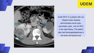 Uro imagenologia Uro imagenologia Uro imagenologia | PPTX