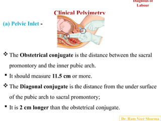 Comprehensive Clinical Pelvimetry for Obstetric Assessment and Fetal ...