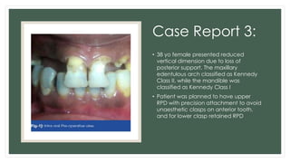Lower Mn Rpd Comprehensive Overview of Precision Attachments in Removable Partial ...