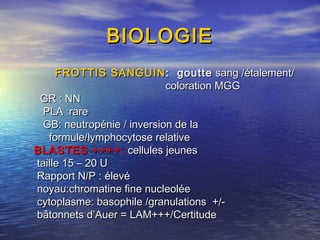 BIOLOGIEBIOLOGIE
FROTTIS SANGUINFROTTIS SANGUIN: goutte: goutte sang /étalement/sang /étalement/
coloration MGGcoloration MGG
GR : NNGR : NN
PLA :rarePLA :rare
GB: neutropénie / inversion de laGB: neutropénie / inversion de la
formule/lymphocytose relativeformule/lymphocytose relative
BLASTES ++++:BLASTES ++++: cellules jeunescellules jeunes
taille 15 – 20 Utaille 15 – 20 U
Rapport N/P : élevéRapport N/P : élevé
noyau:chromatine fine nucleoléenoyau:chromatine fine nucleolée
cytoplasme: basophile /granulations +/-cytoplasme: basophile /granulations +/-
bâtonnets d’Auer = LAM+++/Certitudebâtonnets d’Auer = LAM+++/Certitude
 