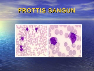 FROTTIS SANGUNFROTTIS SANGUN
 