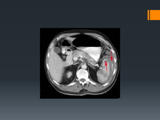 7- Abdominal trauma 1
