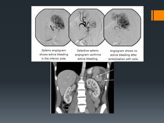 7- Abdominal trauma 1