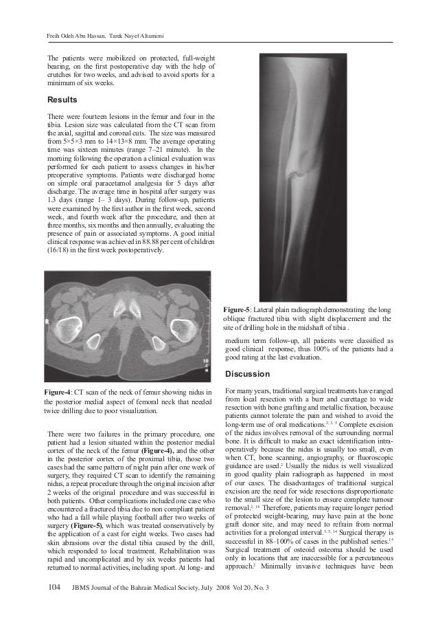 Ablation Of Osteoid Osteoma البروفيسور فريح ابوحسان استشاري جراحة