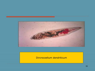 30
Dircrocoelium dendriticum
 