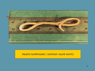 5
Ascaris lumbricoids ( common round worm)
 