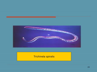 19
Trichinela spiralis
 