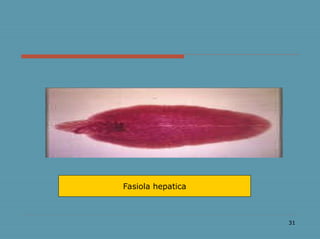 31
Fasiola hepatica
 