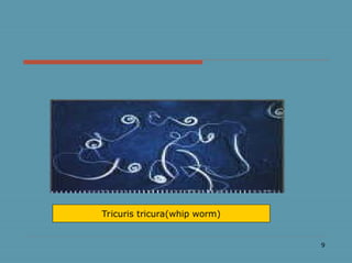 9
Tricuris tricura(whip worm)
 