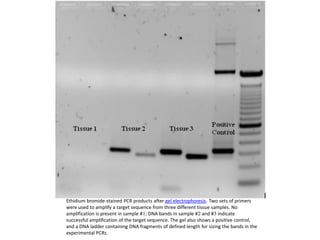 Ethidium bromide-stained PCR products after gel electrophoresis. Two sets of primers
were used to amplify a target sequence from three different tissue samples. No
amplification is present in sample #1; DNA bands in sample #2 and #3 indicate
successful amplification of the target sequence. The gel also shows a positive control,
and a DNA ladder containing DNA fragments of defined length for sizing the bands in the
experimental PCRs.
 