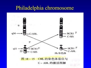 Philadelphia chromosome 