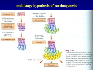 multistage hypothesis of carcinogenesis 