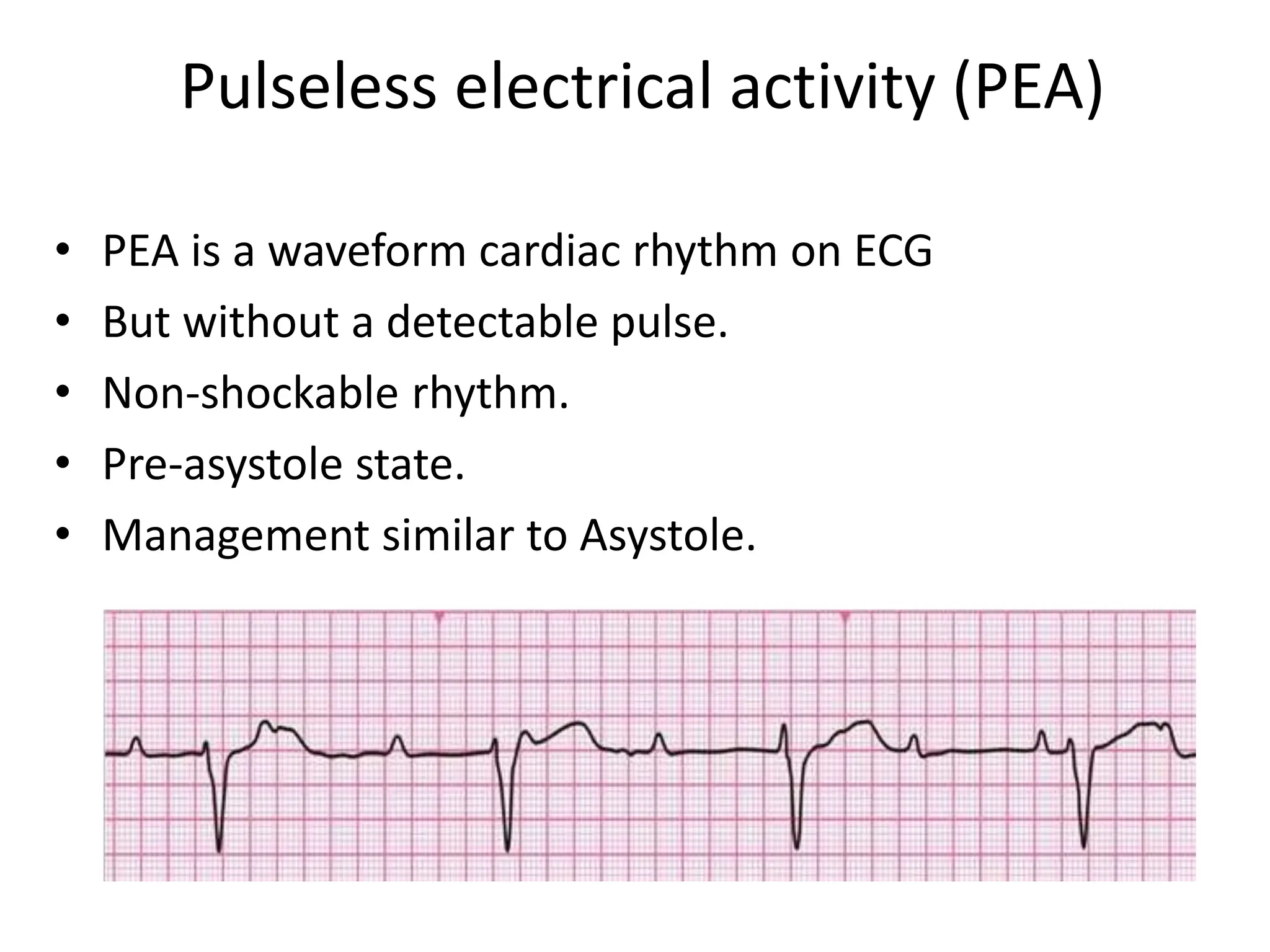 7 Cardiac arrest 1 pptx 7 Cardiac arrest 1 pptx