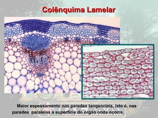 CCoollêênnqquuiimmaa LLaammeellaarr 
Maior espessamento nas paredes tangenciais, isto é, nas 
paredes paralelas a superfície do órgão onde ocorre. 
 